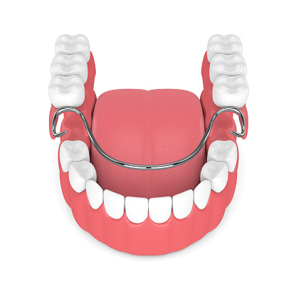 3d render of removable partial denture isolated over white background 3d render of removable partial denture isolated over white background by Cascadia Family Dental in Bend, OR.